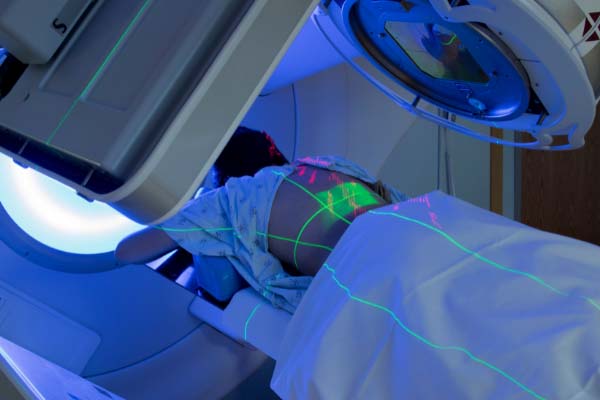 Best Radiotherapy Treatment in Ghaziabad